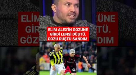 ELİM ALEX&#39;İN GÖZÜNE GİRDİ LENSİ DÜŞTÜ. GÖZÜ DÜŞTÜ SANDIM 