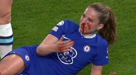 Melanie Leupolz&#39;s Shocking Injury: Lyon Player&#39;s Dangerous Move!!