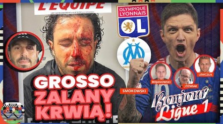 MARSYLIA – LYON: SKANDAL, GROSSO RANIONY! BUŁKA ŚWIETNY W NICEI, MBAPPE RATUJE PSG. BONJOUR LIGUE 1