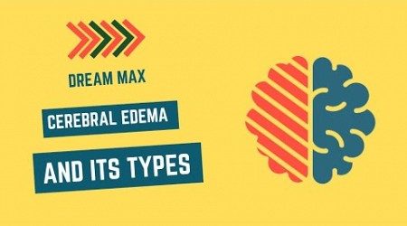 Cerebral Edema and its types | Dream Max