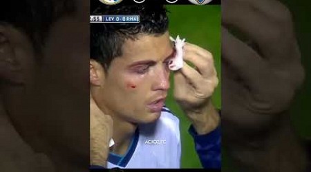 The Day Ronaldo Crash His Eye Real Madrid VS Levante Laliga 2012 #football #shorts #ytshorts