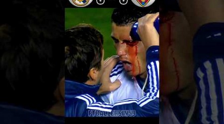 The Day Ronaldo Crashed His Eyes 