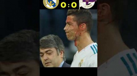 Ronaldo Crashed His Face | Real Madrid Vs deportivo | La Liga 2017 #ronaldo #shorts #football