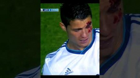 The Day Ronaldo Hurt His Eye 