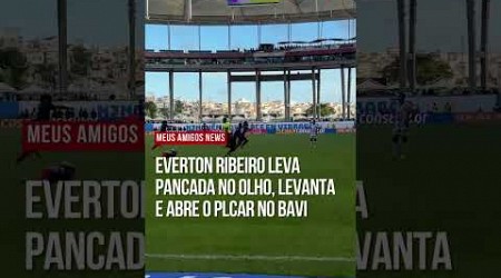 DO SOFRIMENTO A GLÓRIA! Everton Ribeiro leva pancada no olho e logo depois marca o gol do BAHIA