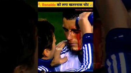 Ronaldo को लगि चोट #football #tiktok #trend #cr7 #cr7football #viralvideo #shorts #ronaldo #tiktok