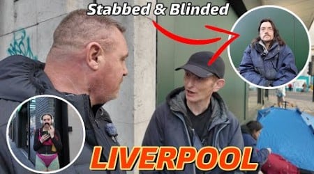 LIVERPOOL- STABBED in the EYE and now totally BLIND!!