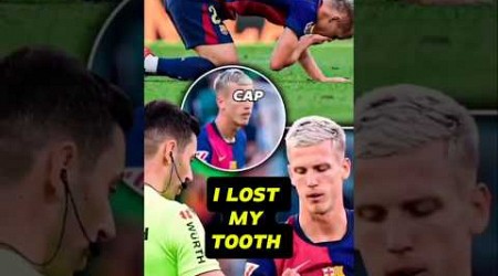 Dani Olmo Loses Tooth in Match Against Betis