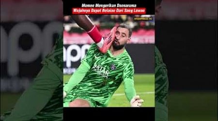 NGERI! Kiper PSG Gianluigi Donnarumma Alami Cedera Horor Setelah Diinjak Wilfried Singo.